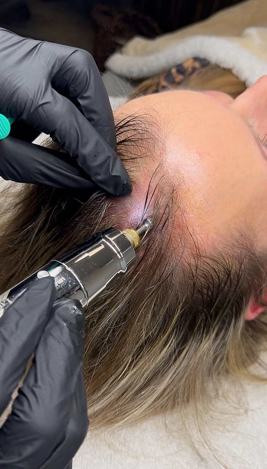MKS Cosmetics – Das abgebildete Produkt ist ein Kasseler Kopfhaut- und Hautanalysator, ein Diagnosegerät zur Beurteilung der Haar- und Kopfhautgesundheit.