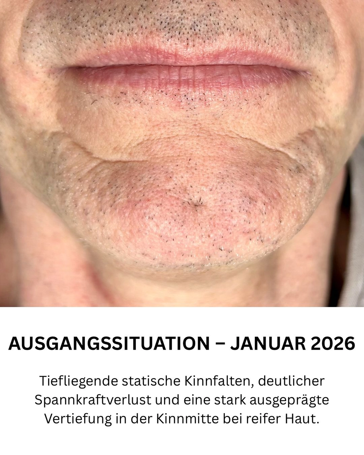Ausgangssituation – Oktober 2024
