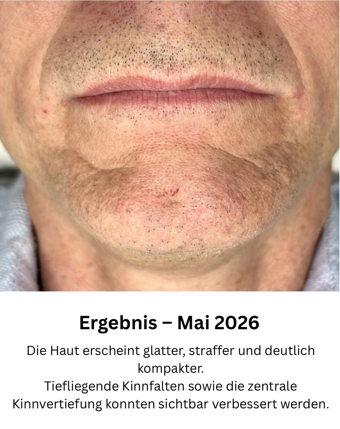Ausgangssituation – Oktober 2024