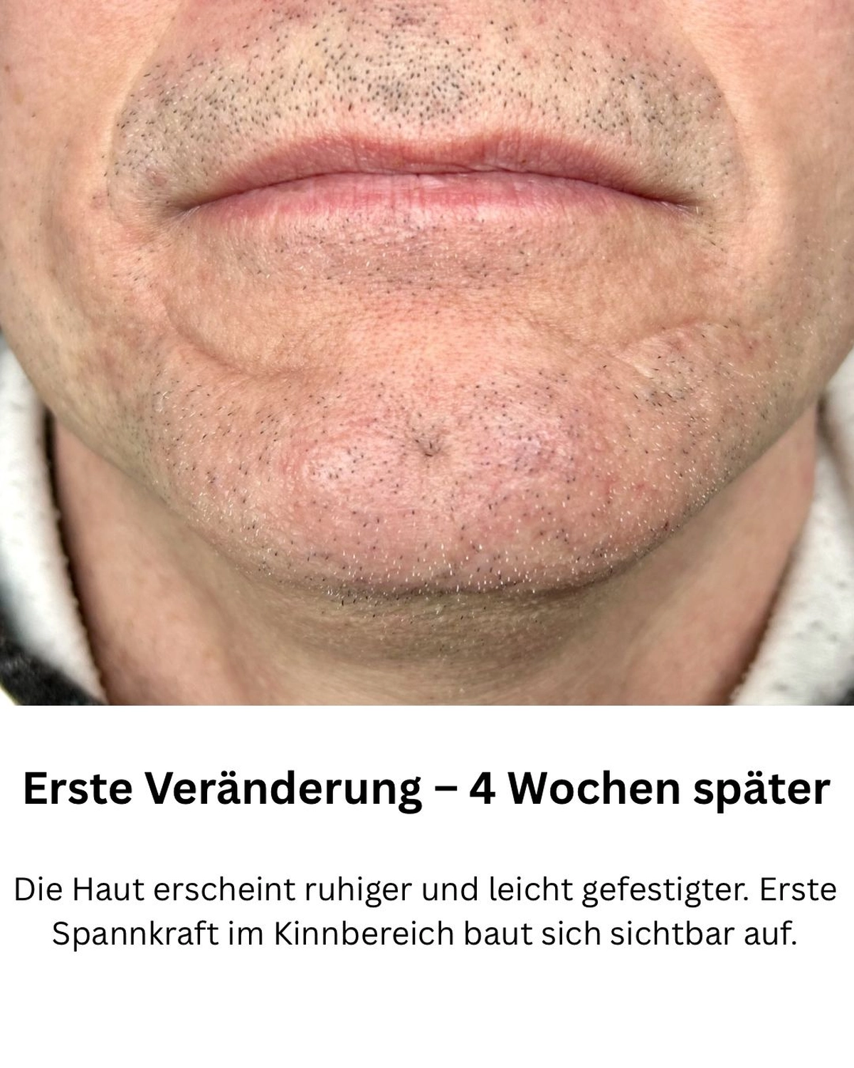 Ausgangssituation – Oktober 2024